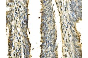 IHC analysis of PSME2 using anti-PSME2 antibody (ABIN7599137).