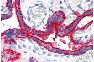 Human Placenta (formalin-fixed, paraffin-embedded) stained with CD59 antibody ABIN290285 at 10 ug/ml followed by biotinylated anti-mouse IgG secondary antibody ABIN481714, alkaline phosphatase-streptavidin and chromogen. (CD59 Antikörper)