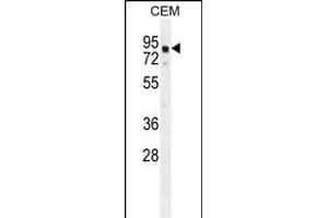 GLB1L2 Antibody (C-term) (ABIN654822 and ABIN2844495) western blot analysis in CEM cell line lysates (35 μg/lane). (GLB1L2 Antikörper  (C-Term))