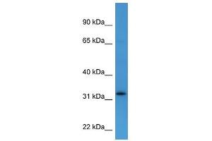 Western Blot showing DOK4 antibody used at a concentration of 1-2 ug/ml to detect its target protein. (DOK4 Antikörper  (C-Term))