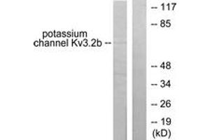 Western blot analysis of extracts from HepG2 cells, using Potassium Channel Kv3. (Kv3.2b Potassium Channel Antikörper  (AA 589-638))