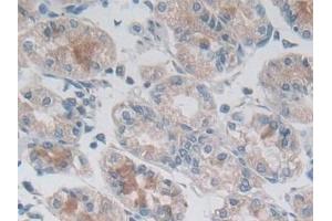 Detection of DSP in Human Stomach Tissue using Polyclonal Antibody to Desmoplakin (DSP)