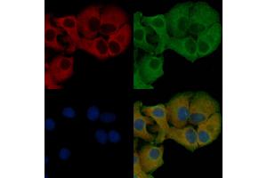 ABIN6257277 and ABIN6275882 staining Hela cells by IF/ICC.