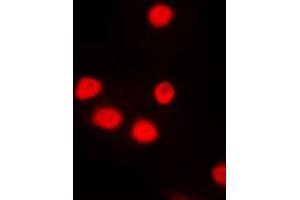 Immunofluorescent analysis of SIX6 staining in NIH3T3 cells. (SIX Homeobox 6 Antikörper  (Center))