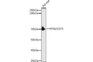 Western blot analysis of extracts of Rat eye, using CD73/NT5E antibody (ABIN3022733, ABIN3022734, ABIN3022735, ABIN1513283 and ABIN6219201) at 1:1000 dilution. (CD73 Antikörper  (AA 290-550))