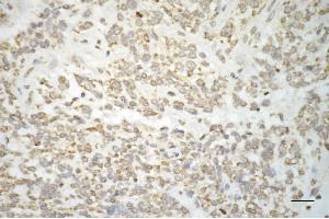 anti-Hydroxyacyl-CoA Dehydrogenase (HADH) antibody