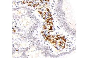 Immunohistochemistry analysis of paraffin-embedded mouse kidney using,STC (ABIN7075723) at dilution of 1: 800 (Stanniocalcin 1 Antikörper)