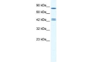WB Suggested Anti-CBX8 Antibody Titration:  0. (CBX8 Antikörper  (Middle Region))