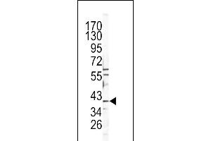 Western blot analysis of CATB Antibody (Center) (ABIN391549 and ABIN2841498) in Y79 cell line lysates (35 μg/lane). (Tyrosinase-Related Protein 1 Antikörper  (AA 198-227))