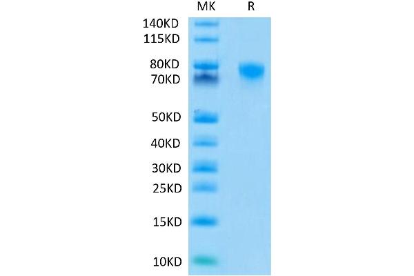 TNFRSF1B Protein (mFc Tag)