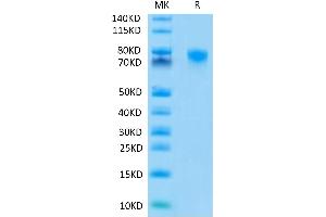 TNFRSF1B Protein (mFc Tag)