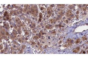 Immunohistochemistry (IHC) image for anti-Cholinergic Receptor, Nicotinic, alpha 5 (Neuronal) (CHRNA5) (Internal Region) antibody (ABIN6260824)