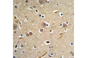 NEDD4 antibody IHC analysis in formalin fixed and paraffin embedded brain tissue.