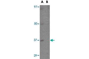 Western blot analysis of EBI3 in K-562 cell lysate with EBI3 polyclonal antibody  at 1 ug/mL in (A) the absence and (B) the presence of blocking peptide. (EBI3 Antikörper  (C-Term))