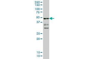 T monoclonal antibody (M02), clone 5C5 Western Blot analysis of T expression in A-549 . (T Brachyury Protein (AA 222-320) Antikörper)