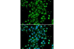 Immunofluorescence analysis of MCF-7 cells using UBE2Z antibody (ABIN5974351). (UBE2Z Antikörper)
