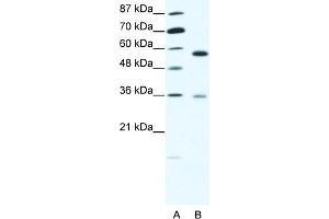 WB Suggested Anti-GDI1 Antibody Titration:  1. (GDI1 Antikörper  (C-Term))