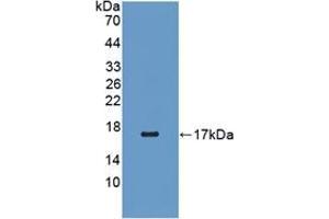 Western blot analysis of recombinant Human RBP5. (Retinol Binding Protein 5 Antikörper  (AA 2-135))