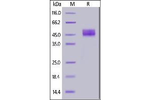 Human CD64, His Tag on  under reducing (R) condition. (FCGR1A Protein (AA 16-281) (His tag))