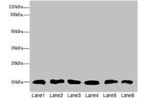 Western blot All lanes: CFL2 antibody at 3. (Cofilin 2 Antikörper  (AA 1-166))