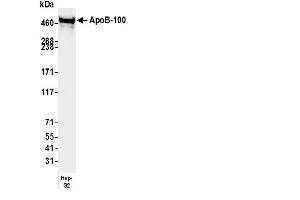 anti-Apoprotein B100 (Apo-B100) antibody