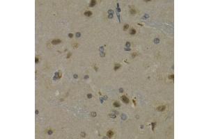 Immunohistochemistry of paraffin-embedded rat brain using MAX antibody (ABIN5971184) at dilution of 1/200 (40x lens). (MAX Antikörper)