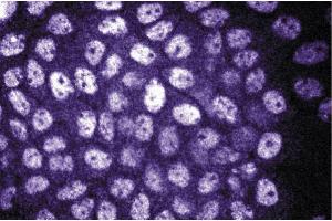 Immunofluorescence staining of A431 cells (Human epithelial carcinoma, ATCC CRL-1555). (DDB1 Antikörper  (AA 739-935))