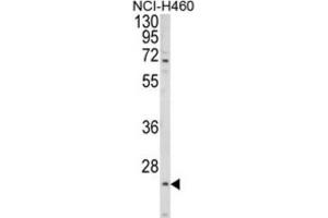 Western Blotting (WB) image for anti-Asparagine-Linked Glycosylation 14 Homolog (ALG14) antibody (ABIN3003954) (ALG14 Antikörper)
