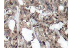 Image no. 3 for anti-V-Akt Murine Thymoma Viral Oncogene Homolog 1 (AKT1) antibody (ABIN265302) (AKT1 Antikörper)