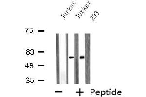Western blot analysis of extracts from Jurkat/293 cells, using SNX1 antibody.