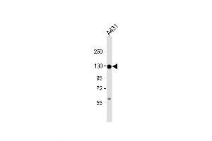 Western Blot at 1:1000 dilution + A431 whole cell lysate Lysates/proteins at 20 ug per lane. (P-Cadherin Antikörper  (N-Term))