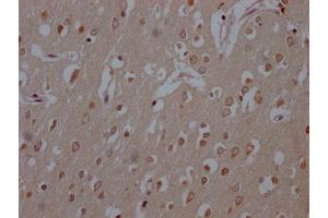 IHC image of ABIN7127433 diluted at 1:100 and staining in paraffin-embedded human brain tissue performed on a Leica BondTM system. (Rekombinanter COMT Antikörper)