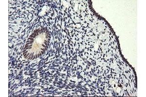Image no. 3 for anti-SEC14 and Spectrin Domains 1 (SESTD1) antibody (ABIN1501066)