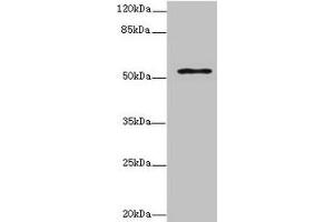 Western blot All lanes: ZNF610 antibody at 7 μg/mL + MCF-7 whole cell lysate Secondary Goat polyclonal to rabbit IgG at 1/10000 dilution Predicted band size: 54, 49 kDa Observed band size: 54 kDa (ZNF135 Antikörper  (AA 1-200))