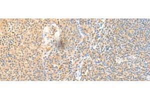 Immunohistochemistry of paraffin-embedded Human tonsil tissue using SSC4D Polyclonal Antibody at dilution of 1:70(x200) (SRCRB4D Antikörper)