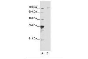 Image no. 1 for anti-Interleukin-1 Receptor-Associated Kinase 3 (IRAK3) (AA 441-490) antibody (ABIN6736196) (IRAK3 Antikörper  (AA 441-490))
