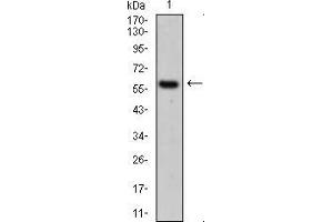 Western blot analysis using CK5 mouse mAb against A431 cell lysate. (Cytokeratin 5 Antikörper  (AA 316-590))
