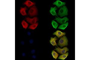 ABIN6265302 and ABIN6278531 staining Hela cells by IF/ICC. (ST3GAL3 Antikörper  (C-Term))