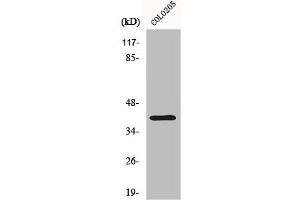 Western Blot analysis of COLO205 cells using Dok-6 Polyclonal Antibody (DOK6 Antikörper  (Internal Region))