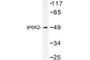 Image no. 1 for anti-Inositol Hexakisphosphate Kinase 2 (IP6K2) antibody (ABIN317720)