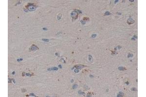 Detection of PSAP in Human Cerebrum Tissue using Polyclonal Antibody to Prosaposin (PSAP) (Prosaposin Antikörper  (AA 17-524))