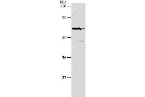 Western Blot analysis of Hela cell using PKM Polyclonal Antibody at dilution of 1:500 (PKM Antikörper)
