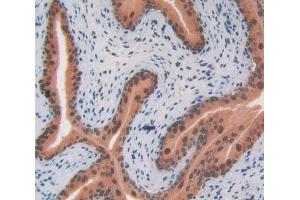 IHC-P analysis of Mouse Testis Tissue, with DAB staining. (CS Antikörper  (AA 174-428))