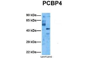 Host:  Rabbit  Target Name:  PCBP4  Sample Tissue:  Human Ovary Tumor, Human 293T  Antibody Dilution:  1. (PCBP4 Antikörper  (C-Term))