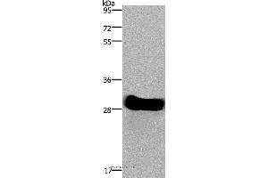 Western blot analysis of Mouse heart tissue, using FHL2 Polyclonal Antibody at dilution of 1:1900