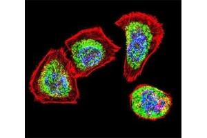 Confocal immunofluorescent analysis of Vimentin antibody with U251 cells followed by Alexa Fluor 488-conjugated goat anti-rabbit lgG (green).