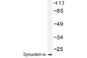 Image no. 1 for anti-Synuclein, alpha (SNCA) antibody (ABIN317944) (SNCA Antikörper)