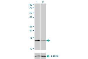 Western Blotting (WB) image for anti-Replication Protein A3, 14kDa (RPA3) (AA 12-121) antibody (ABIN598583) (RPA3 Antikörper  (AA 12-121))