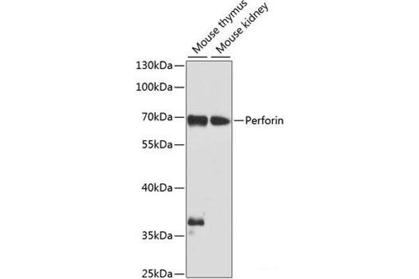 Perforin 1 Antikörper