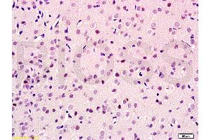 Formalin-fixed and paraffin embedded rat brain tissue labeled with Anti-GIG8/ID2 Polyclonal Antibody, Unconjugated (ABIN747473) at 1:100 followed by conjugation to the secondary antibody and DAB staining